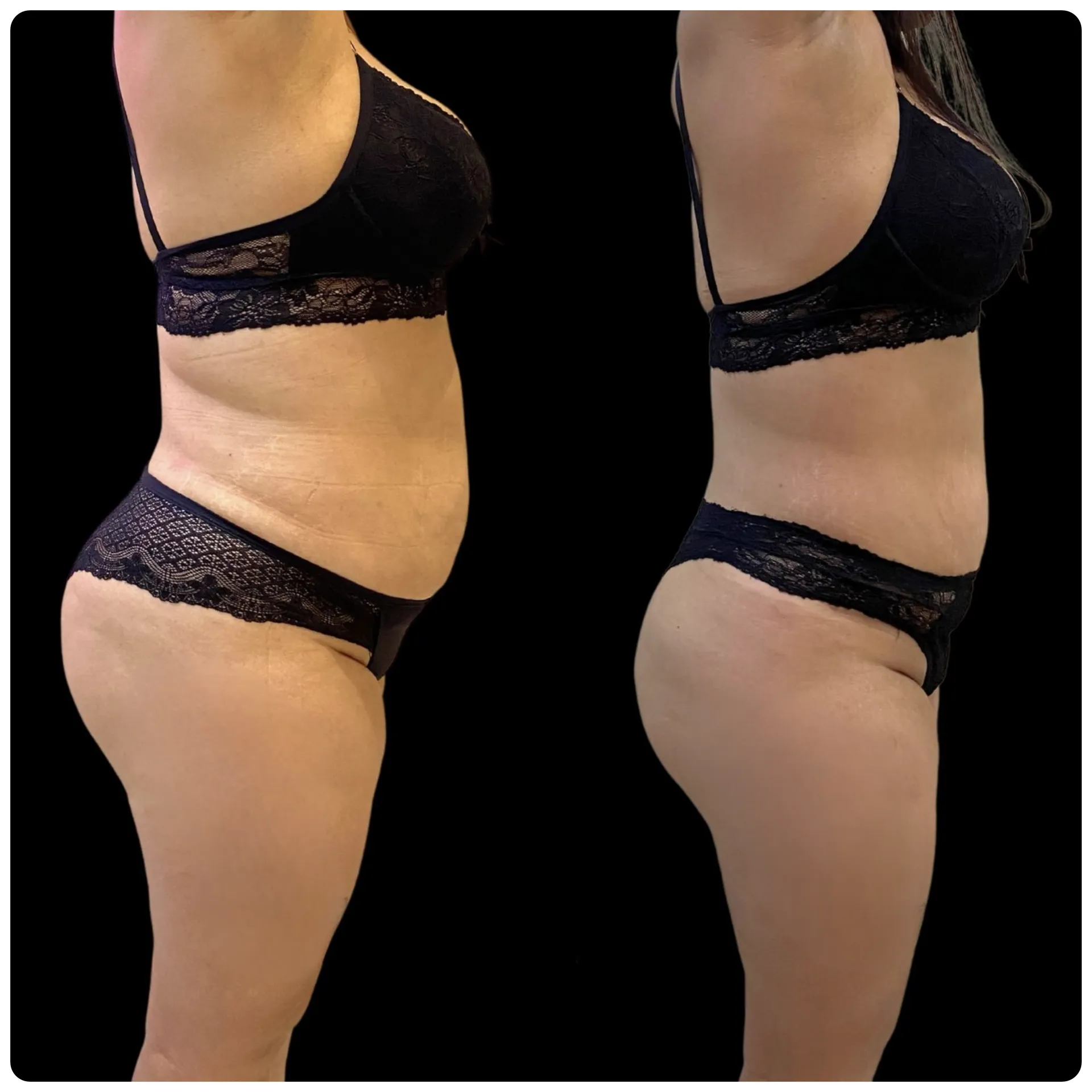 Resultado comprovado